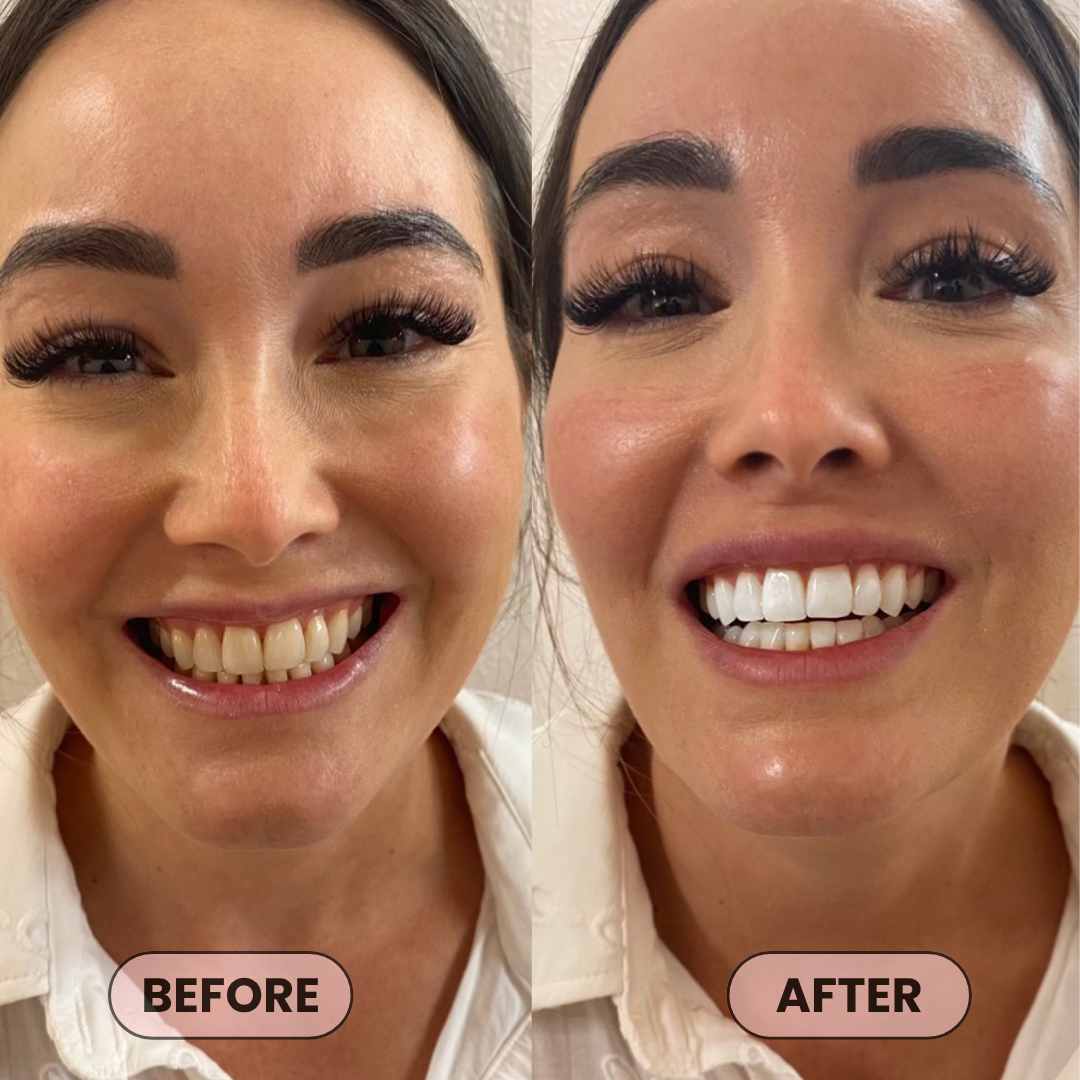 niacinamide whitening toothpaste