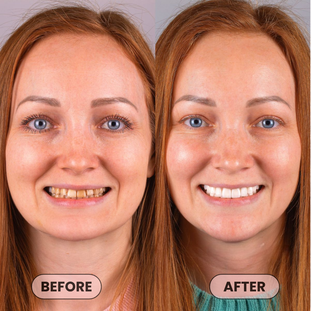 niacinamide whitening toothpaste