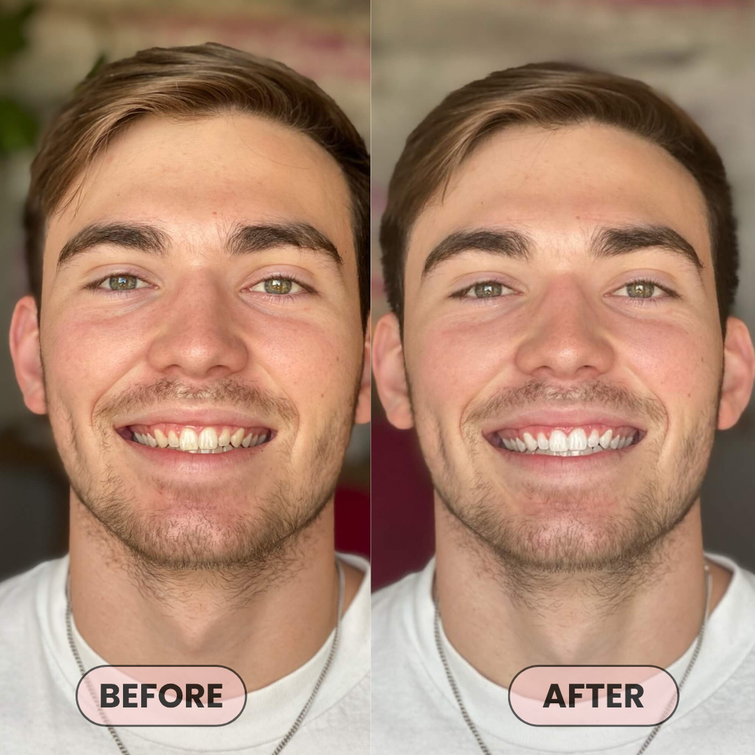 niacinamide whitening toothpaste