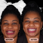 niacinamide whitening toothpaste